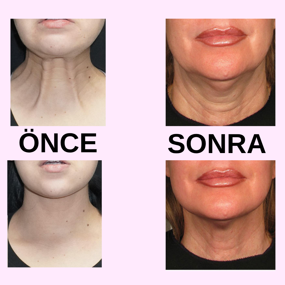 Amoria Gold Boyun Kolajen Maskesi